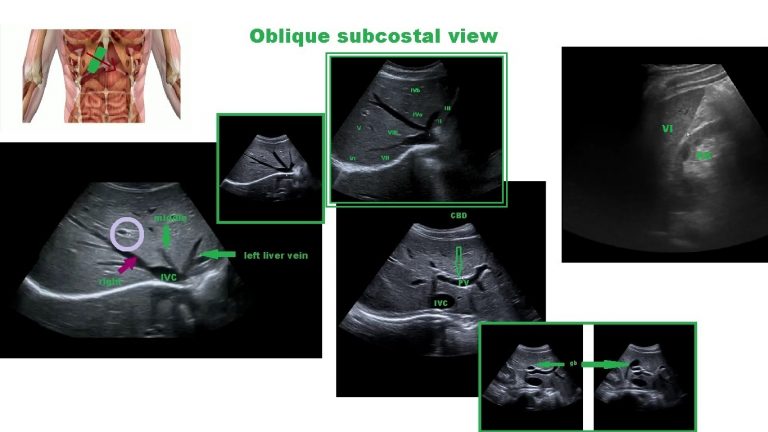 Liver ultrasound views – theGastroenterologist